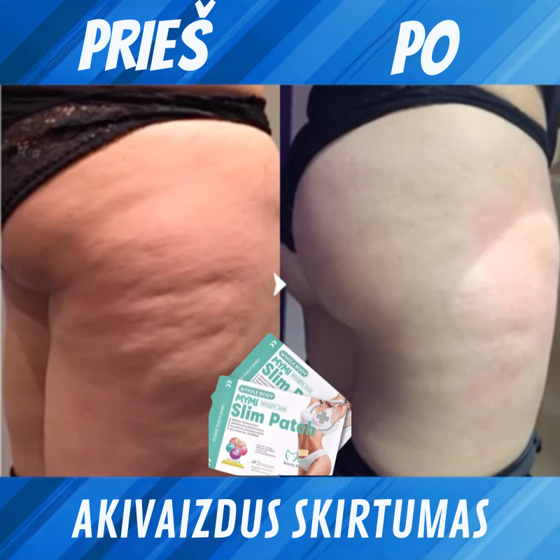 Detoksikuojantis anticeliulitinis liekninantis pleistras